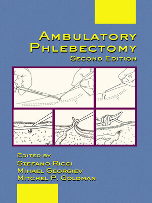 cover image of Ambulatory Phlebectomy